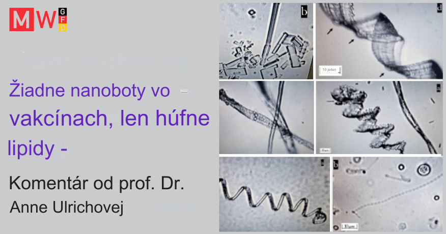 Štúdia spôsobuje rozruch: nanoboty odhalené vo vakcínach?